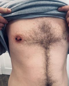 nipple piercing derby