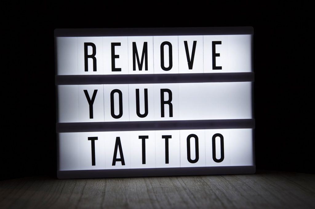 tattoo removal derby
